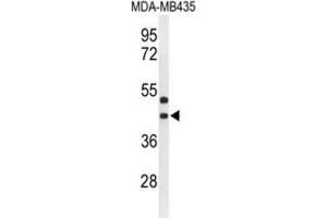 Western Blotting (WB) image for anti-G Protein-Coupled Receptor 17 (GPR17) antibody (ABIN3004347) (GPR17 抗体)