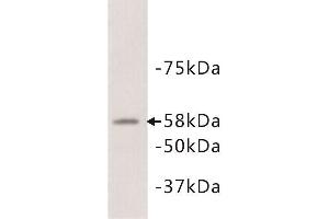 Western Blotting (WB) image for anti-Alkaline Phosphatase (ALP) antibody (ABIN1854820) (Alkaline Phosphatase 抗体)