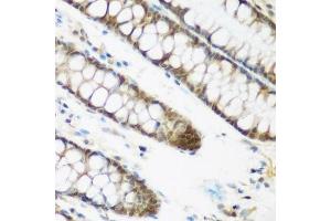 Immunohistochemistry of paraffin-embedded human colon using NCBP2 antibody. (NCBP2 抗体  (AA 1-156))