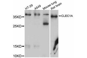 Western blot analysis of extracts of various cell lines, using CLEC1A antibody (ABIN5997458) at 1/1000 dilution. (CLEC1A 抗体)