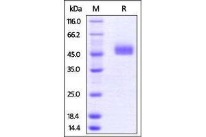 SDS-PAGE (SDS) image for T Cell Immunoreceptor with Ig and ITIM Domains (TIGIT) (AA 26-143) (Active) protein (Fc Tag) (ABIN2870763)