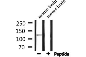 Western Blotting (WB) image for anti-Nitric Oxide Synthase 2, Inducible (NOS2) (C-Term) antibody (ABIN6262590)