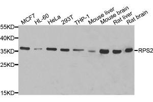 Western blot analysis of extracts of various cell lines, using RPS2 antibody. (RPS2 抗体  (AA 1-293))