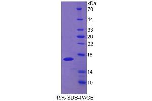 SDS-PAGE analysis of Mouse UPK1A Protein. (UPK1A 蛋白)