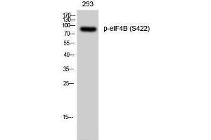 Western Blotting (WB) image for anti-Eukaryotic Translation Initiation Factor 4B (EIF4B) (pSer422) antibody (ABIN3182179) (EIF4B 抗体  (pSer422))