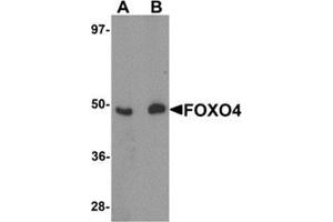 Western blot analysis of FOXO4 in HeLa cell lysate with FOXO4 antibody at (A) 0. (FOXO4 抗体  (N-Term))