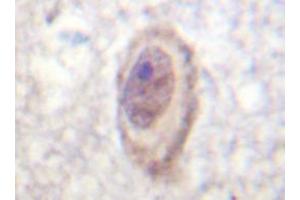 Immunohistochemistry analyzes of C-Raf antibody in paraffin-embedded human brain tissue. (RAF1 抗体)