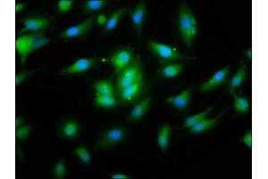 Immunofluorescence staining of Hela cells with ABIN7160821 at 1:133, counter-stained with DAPI. (NLRP1 抗体  (AA 589-655))