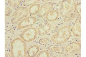 Immunohistochemistry of paraffin-embedded human kidney tissue using ABIN7150306 at dilution of 1:100 (DNA2 抗体  (AA 1-300))