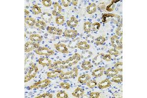 Immunohistochemistry of paraffin-embedded rat kidney using PIK3CA antibody. (PIK3CA 抗体  (AA 401-600))