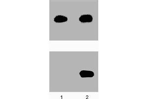 A431 cells were either left untreated (-) or treated (+) with 100 ng/ml EGF for 5 minutes at 37°C. (STAT5A 抗体  (pTyr694))