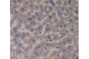 Used in DAB staining on fromalin fixed paraffin- embedded liver tissue