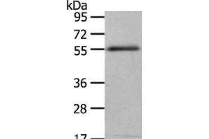 Western Blot analysis of 293T cell using ENPP7 Polyclonal Antibody at dilution of 1:700 (ENPP7 抗体)