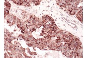 Immunohistochemistry (IHC) image for anti-Complement Component 1, Q Subcomponent Binding Protein (C1QBP) (AA 232-282) antibody (ABIN7453535) (C1QBP 抗体  (AA 232-282))