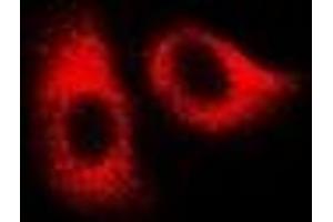 Immunofluorescent analysis of HSPA1L staining in U2OS cells. (HSPA1L 抗体)