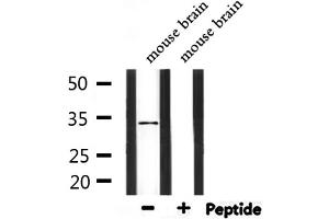 Western Blotting (WB) image for anti-Phosphatidylinositol Glycan C (PIGC) (Internal Region) antibody (ABIN6264204)