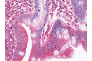 Immunohistochemistry (IHC) image for anti-Neurotrophic tyrosine Kinase, Receptor, Type 3 (NTRK3) (AA 31-61) antibody (ABIN1918828)