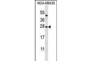 KLRC1 Antibody (N-term) (ABIN656501 and ABIN2845775) western blot analysis in MDA-M cell line lysates (35 μg/lane). (KLRC1 抗体  (N-Term))