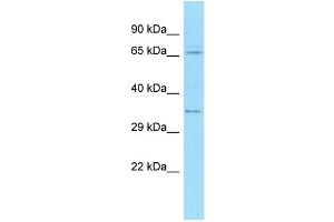 WB Suggested Anti-TXLNA Antibody Titration: 1. (alpha Taxilin 抗体  (N-Term))
