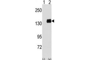 Western Blotting (WB) image for anti-Pumilio Homolog 1 (PUM1) antibody (ABIN3003296) (PUM1 抗体)