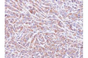 Immunohistochemistry (IHC) image for anti-Protein Phosphatase 1, Catalytic Subunit, alpha Isoform (PPP1CA) (Center) antibody (ABIN2856071)
