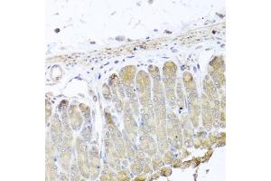 Immunohistochemistry of paraffin-embedded mouse stomach using IRS2 antibody. (IRS2 抗体)