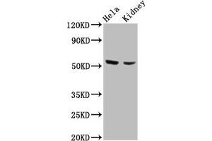 Western Blot Positive WB detected in: Hela whole cell lysate, Mouse kidney tissue All lanes: POLK antibody at 4. (POLK 抗体  (AA 227-337))