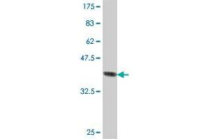 Western Blotting (WB) image for anti-NADH Dehydrogenase (Ubiquinone) 1 beta Subcomplex, 10, 22kDa (NDUFB10) (AA 73-172) antibody (ABIN561941)