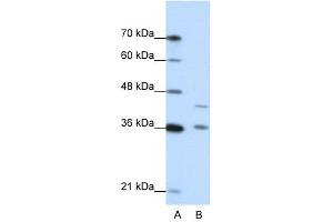 NKD2 antibody used at 0. (NKD2 抗体)