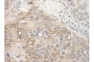 Immunohistochemistry (IHC) image for anti-Zinc Finger, CCHC Domain Containing 11 (ZCCHC11) (AA 250-300) antibody (ABIN7448876) (ZCCHC11 抗体  (AA 250-300))