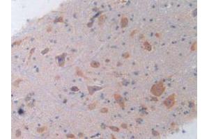 IHC-P analysis of Rat Spinal Cord Tissue, with DAB staining. (IL-4 抗体  (AA 61-111))