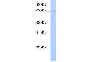 Copine IV antibody used at 1 ug/ml to detect target protein. (Copine IV 抗体  (C-Term))