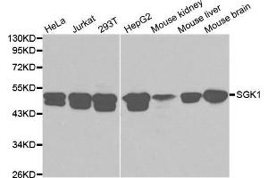 Western blot analysis of extracts of various cell lines, using SGK1 antibody. (SGK1 抗体  (AA 172-431))