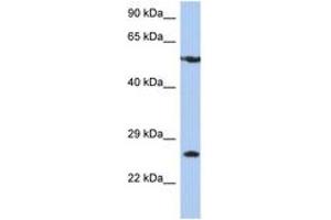 Image no. 1 for anti-Zinc Finger Protein 10 (ZNF10) (AA 107-156) antibody (ABIN6744401) (ZNF10 抗体  (AA 107-156))