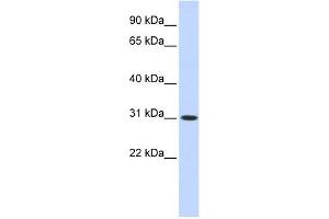 CYB5D2 antibody used at 1 ug/ml to detect target protein. (CYB5D2 抗体  (N-Term))