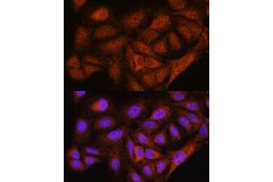 Immunofluorescence (IF) image for anti-RNA-Binding Protein NOB1 (NOB1) (AA 1-230) antibody (ABIN7270109)