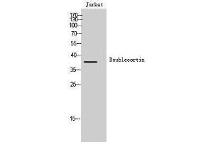Western Blotting (WB) image for anti-Doublecortin (DCX) (Ser30) antibody (ABIN3184351) (Doublecortin 抗体  (Ser30))