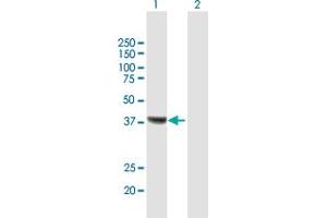 Western Blot analysis of RSAD2 expression in transfected 293T cell line by RSAD2 MaxPab polyclonal antibody. (RSAD2 抗体  (AA 1-361))
