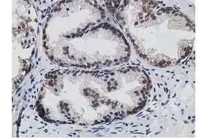 Immunohistochemical staining of paraffin-embedded Human prostate tissue using anti-HPGD mouse monoclonal antibody. (HPGD 抗体)