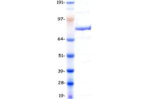 Validation with Western Blot