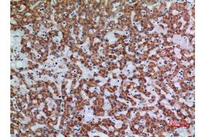 Immunohistochemistry (IHC) analysis of paraffin-embedded Human Liver, antibody was diluted at 1:100. (APAF1 抗体  (Internal Region))