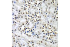 Immunohistochemistry of paraffin-embedded mouse kidney using SEPT7 antibody (ABIN5974146) at dilution of 1/100 (40x lens). (Septin 7 抗体)