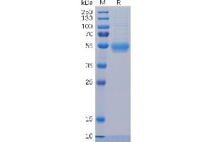 SDS-PAGE (SDS) image for Interleukin 5 Receptor, alpha (IL5RA) (AA 21-338) protein (His tag) (ABIN6961143)