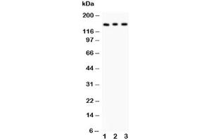 Western blot testing of Insulin Receptor antibody and Lane 1:  rat kidney (Insulin Receptor 抗体  (AA 1353-1372))