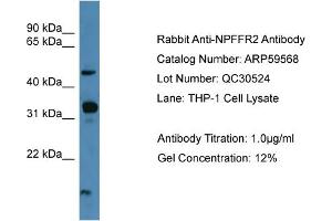 WB Suggested Anti-NPFFR2  Antibody Titration: 0. (NPFFR2 抗体  (C-Term))