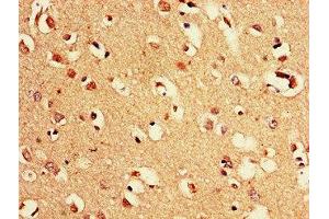 Immunohistochemistry of paraffin-embedded human brain tissue using ABIN7169128 at dilution of 1:100 (PAK3 抗体  (AA 70-190))