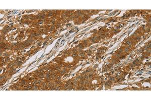 Immunohistochemistry (Paraffin-embedded Sections) (IHC (p)) image for anti-Cytochrome P450, Family 27, Subfamily A, Polypeptide 1 (CYP27A1) antibody (ABIN7236729)