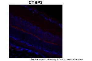 Sample Type: complete mouse retina sectionsRed: PrimaryBlue: DAPIPrimary Dilution: 1:200Secondary Antibody: Goat anti-Rabbit AF568 IgG(H+L)Secondary Dilution: 1:200Image Submitted by: David ZenisekYale University (CTBP2 抗体  (C-Term))