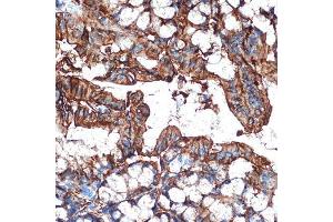 Immunohistochemistry (IHC) image for anti-Galectin 4 (LGALS4) antibody (ABIN1679347)