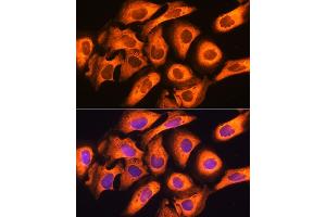 Immunofluorescence analysis of U20S cells using Rig-I/DDX58 antibody (ABIN6130263, ABIN6139513, ABIN6139515 and ABIN6217394) at dilution of 1:100. (DDX58 抗体  (AA 726-925))